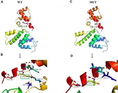 A novel heterozygous SIX1 missense mutation resulted in non-syndromic unilateral hearing loss